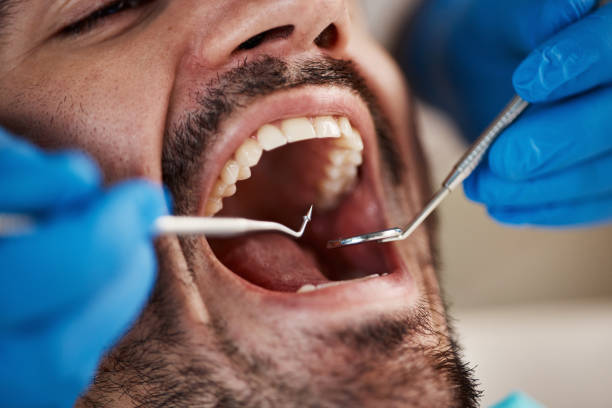Best Emergency Tooth Extraction in Sans Souci, SC
